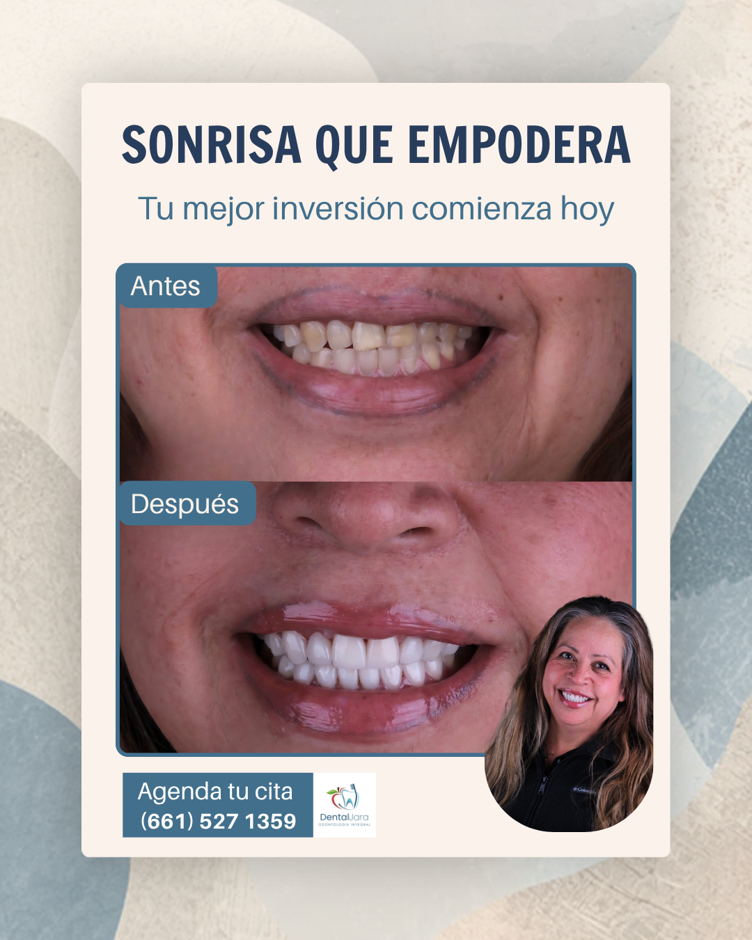 Home 4. Dental Jara Sonrisa Conversion Directa
